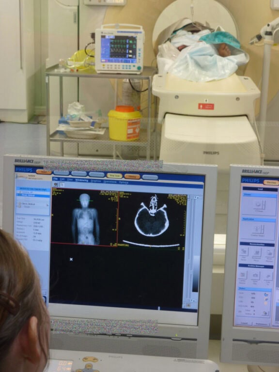 philips brilliance ct scanner